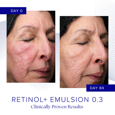 Retinol+ Emulsion 0.3