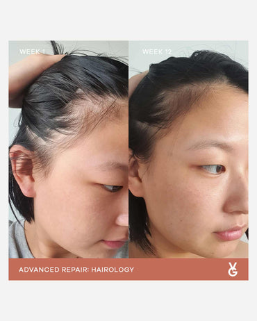 VIDA GLOW - HAIROLOGY
