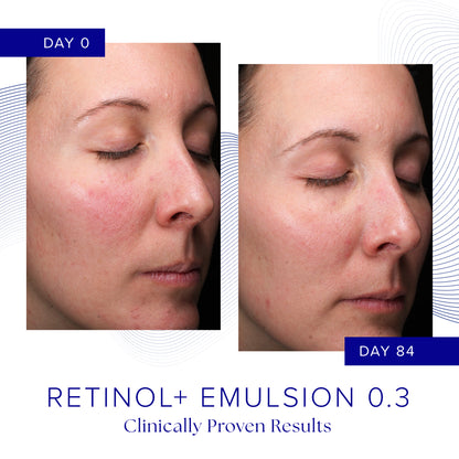 Retinol+ Emulsion 0.3