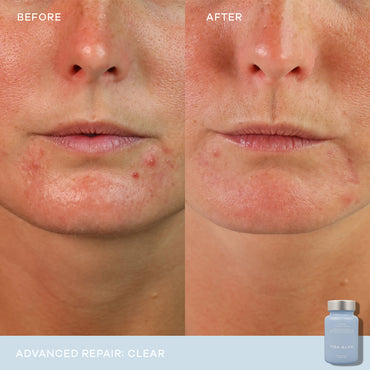 VIDA GLOW - CLEAR