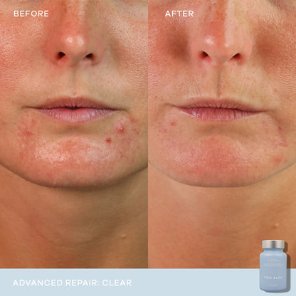 VIDA GLOW - CLEAR