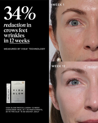 VIDA GLOW - PRO COLLAGEN+